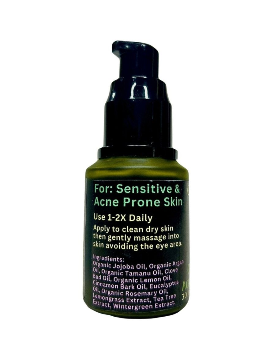 Clear Skin Original Acne Safe Serum - Green + Beauty Skincare