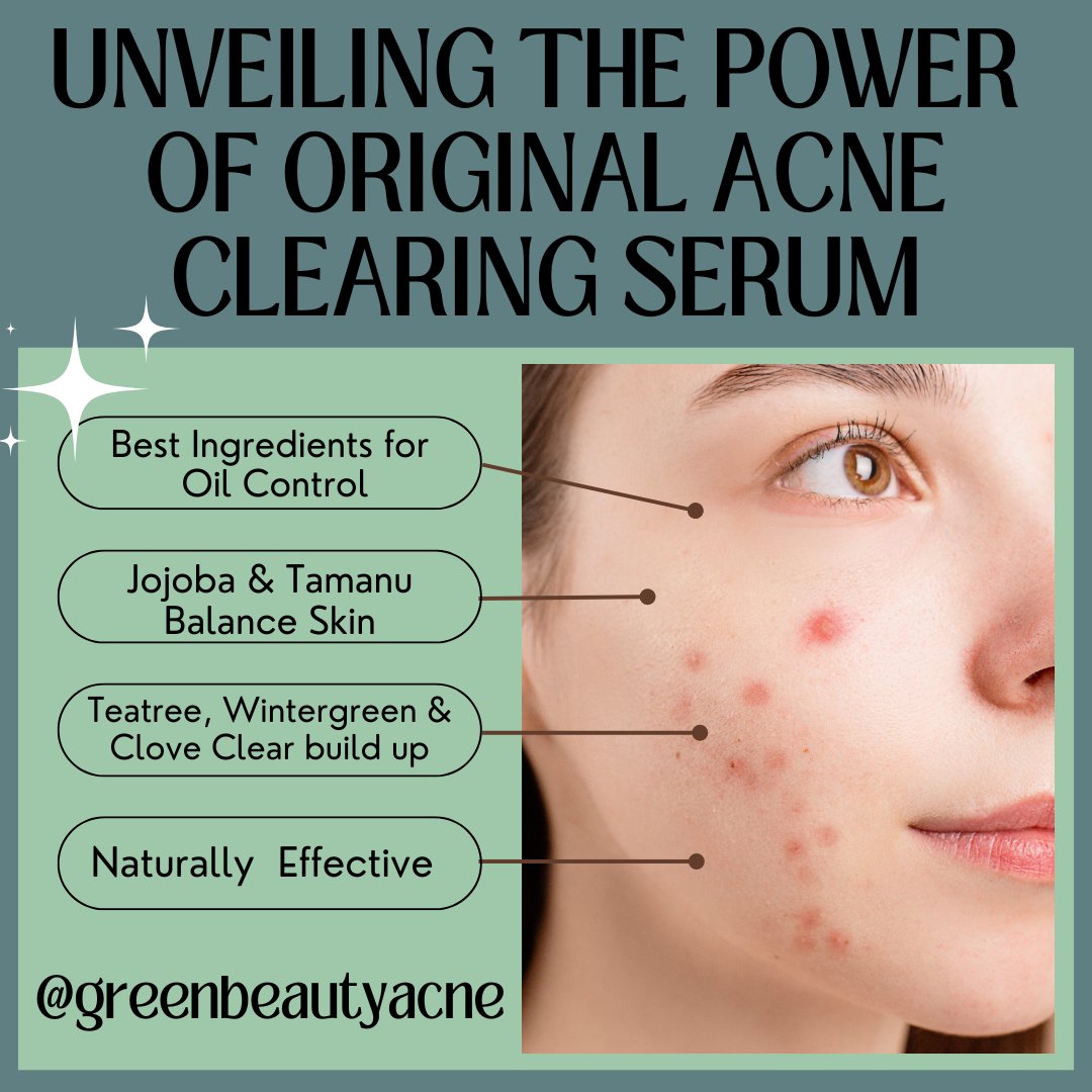 Unveiling the Power of Original Acne Clearing Serum: A Natural Solution for Acne-Prone Skin - Green + Beauty Skincare